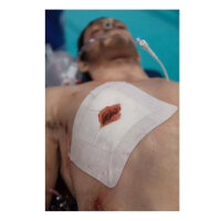 Russel Chest Seal vented Thorax Pflaster 20 x 15cm