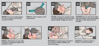 Rhino Rescue Nasal Airway